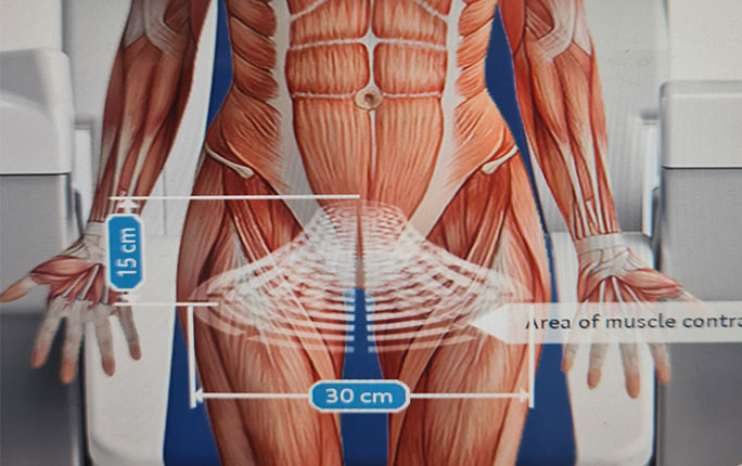 PelviCenter